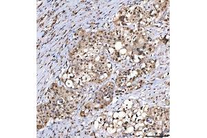 IHC analysis of SNRPD2 using anti-SNRPD2 antibody (ABIN7598963).