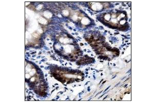 anti-Small Ubiquitin Related Modifier 2/3 (SUMO2/3) (AA 24-72) antibody