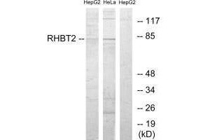 Western blot analysis of extracts from HepG2 cells and HeLa cells, using RHBT2 antibody. (RHOBTB2 抗体)