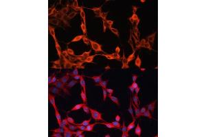Immunofluorescence analysis of NIH/3T3 cells using SLC25 antibody  at dilution of 1:100. (SLC25A23 抗体  (AA 1-160))