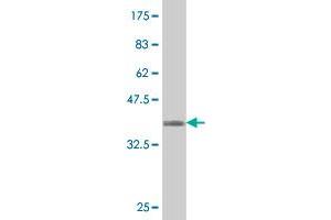 Western Blot detection against Immunogen (36. (IGFBPI 抗体  (AA 160-259))