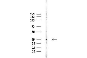 anti-Sterol O-Acyltransferase 2 (SOAT2) (C-Term) antibody
