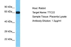 Host: Rabbit Target Name: TTC22 Sample Type: Placenta lysates Antibody Dilution: 1. (TTC22 抗体  (N-Term))