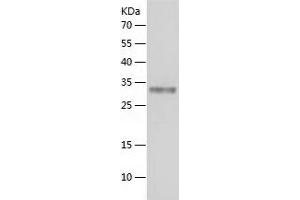 PTPRN Protein (AA 693-979) (His tag)