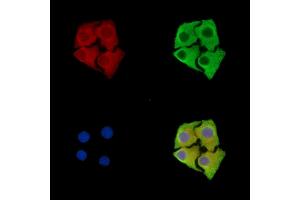 ABIN7096248 and ABIN7100310 staining Hela cells by IF/ICC. (Sbk2 抗体)