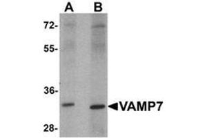 Western blot analysis of VAMP7 in mouse lung tissue lysate with VAMP7 Antibody  at 1 ug/mL. (VAMP7 抗体  (N-Term))