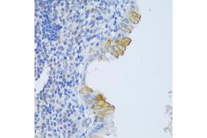 Immunohistochemistry of paraffin-embedded human appendix using CRA antibody (ABIN6132087, ABIN6138999, ABIN6139001 and ABIN6217973) at dilution of 1:150 (40x lens). (EFCAB4B 抗体  (AA 1-200))