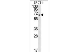 N4BP3 Antibody (N-term) (ABIN651821 and ABIN2840413) western blot analysis in ZR-75-1 cell line lysates (15 μg/lane). (N4BP3 抗体  (N-Term))