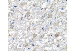 Immunohistochemistry of paraffin-embedded Rat brain using MTX1 Polyclonal Antibody at dilution of 1:100 (40x lens). (Metaxin 1 抗体)