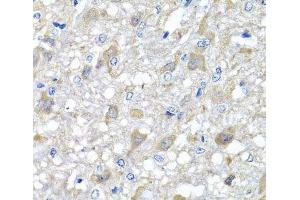 Immunohistochemistry of paraffin-embedded Rat brain using MTX1 Polyclonal Antibody at dilution of 1:100 (40x lens). (Metaxin 1 抗体)
