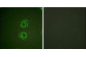 Immunofluorescence analysis of HuvEc cells, using HER3 (Ab-1222) Antibody. (ERBB3 抗体  (AA 1191-1240))