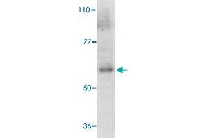 Western blot analysis of IL21R expression in human Raji cell lysate with IL21R polyclonal antibody  at 1 ug /mL . (IL21 Receptor 抗体  (AA 97-111))