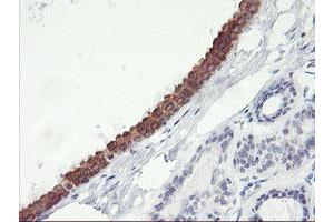 Immunohistochemical staining of paraffin-embedded Human breast tissue using anti-C20orf3 mouse monoclonal antibody. (APMAP 抗体)