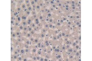 IHC-P analysis of Rat Tissue, with DAB staining. (Complement Factor B 抗体  (AA 476-592))