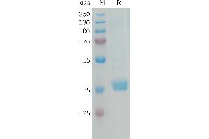 SDS-PAGE (SDS) image for Microfibrillar-Associated Protein 4 (MFAP4) (AA 22-255) protein (His tag) (ABIN7538394)