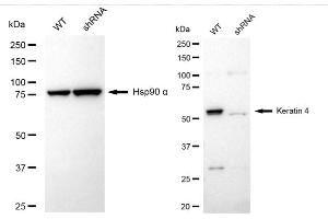 Western blotting analysis using Keratin 4 antibody (ABIN7799178).