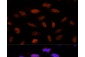 Immunofluorescence analysis of U-2 OS cells using ADNP Polyclonal Antibody at dilution of 1:100 (40x lens). (ADNP 抗体)