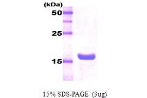 Figure annotation denotes ug of protein loaded and % gel used. (Pituitary Growth Hormone 20kDa 蛋白)