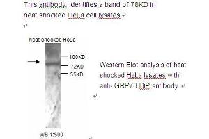 Image no. 1 for anti-Heat Shock 70kDa Protein 5 (Glucose-Regulated Protein, 78kDa) (HSPA5) antibody (ABIN790797) (GRP78 抗体)