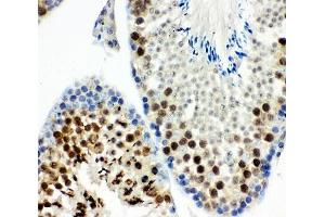 IHC-P: MCAK antibody testing of mouse testis tissue (KIF2C 抗体  (AA 531-725))