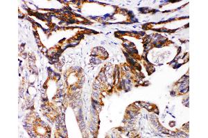 Immunohistochemistry (IHC) image for anti-Deleted in Colorectal Carcinoma (DCC) (AA 162-178), (N-Term) antibody (ABIN3044119)