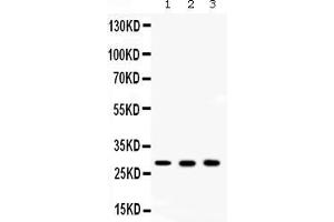 Western blot analysis of CA2 using anti- CA2 antibody .