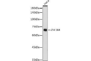 Western blot analysis of extracts of HeLa cells, using ZNF384 antibody (ABIN7271478) at 1:1000 dilution. (ZNF384 抗体  (AA 1-180))