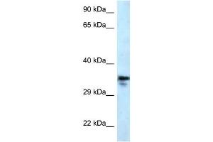 Western Blot showing MMACHC antibody used at a concentration of 1 ug/ml against U937 Cell Lysate (MMACHC 抗体  (C-Term))