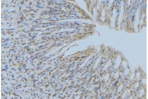 ABIN6277248 at 1/100 staining Human gastric tissue by IHC-P. (ACP5 抗体  (N-Term))