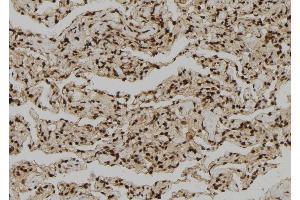 ABIN6272311 at 1/100 staining Human lung tissue by IHC-P. (GZMH 抗体)