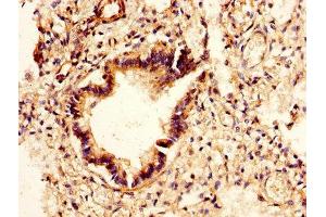 IHC image of ABIN7147557 diluted at 1:400 and staining in paraffin-embedded human lung tissue performed on a Leica BondTM system. (CHI3L2 抗体  (AA 27-390))