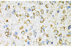 Immunohistochemistry of paraffin-embedded Rat brain using LRPAP1 Polyclonal Antibody at dilution of 1:200 (40x lens). (LRPAP1 抗体)