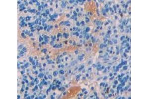 Used in DAB staining on fromalin fixed paraffin- embedded Kidney tissue (CBL 抗体  (AA 558-816))