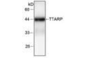 Image no. 1 for anti-tyrosyl-DNA phosphodiesterase 2 (TDP2) antibody (ABIN791474) (TDP2 抗体)