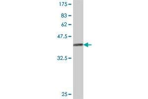 Western Blot detection against Immunogen (36. (LIPA3 抗体  (AA 1043-1139))