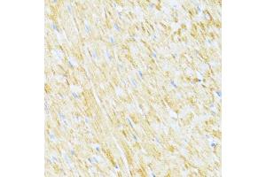 Immunohistochemistry (IHC) image for anti-Ubiquinol-Cytochrome C Reductase, Complex III Subunit X (UQCR10) (AA 1-63) antibody (ABIN6149956)