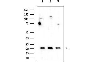 Western blot analysis of lysates from various samples, using RPL17 Mouse Monoclonal Antibody at 1/1000 dilution.