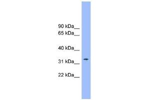 Western Blotting (WB) image for anti-Solute Carrier Family 25 (Mitochondrial Carrier, Citrate Transporter), Member 1 (Slc25a1) (Middle Region) antibody (ABIN2781624)