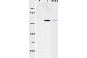 L1 rat intestine lysates L2 rat brain lysates probed with Anti SOAT2/ACAT2 Polyclonal Antibody, Unconjugated (ABIN708476) at 1:200 overnight at 4 °C. (SOAT2 抗体  (AA 331-430))