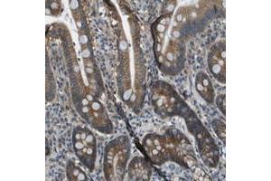 Immunohistochemical staining of human duodenum with TMEM51 polyclonal antibody  shows moderate cytoplasmic positivity in glandular cells at 1:50-1:200 dilution. (TMEM51 抗体)