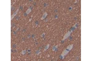 IHC-P analysis of Human Tissue, with DAB staining. (TWSG1 抗体  (AA 26-223))