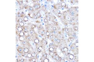 Immunohistochemistry of paraffin-embedded human liver using AADAT Rabbit pAb (ABIN6127318, ABIN6136315, ABIN6136317 and ABIN6216952) at dilution of 1:200 (40x lens). (AADAT 抗体  (AA 34-429))