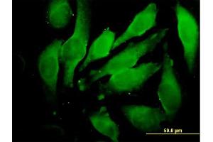 Immunofluorescence of purified MaxPab antibody to GRN on HeLa cell. (Granulin 抗体  (AA 1-593))