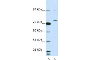 Western Blotting (WB) image for anti-Exosome Component 10 (EXOSC10) antibody (ABIN2462060) (EXOSC10 抗体)