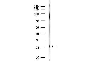 Western blot analysis of lysates from MDA-MB-231 cells, using Phospho-HSP27 (Ser15) Antibody at 1/1000 dilution.