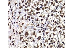 Immunohistochemistry (Paraffin-embedded Sections) (IHC (p)) image for anti-DnaJ (Hsp40) Homolog, Subfamily B, Member 6 (DNAJB6) antibody (ABIN7263009)