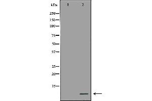 Western blot analysis of Hela cell lysate, using MT2A Antibody. (MT2A 抗体)