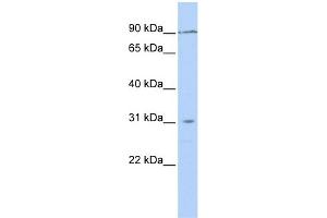WB Suggested Anti-TMEM146 Antibody Titration: 0. (TMEM146 抗体  (N-Term))