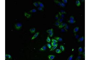 Immunofluorescent analysis of HepG2 cells using ABIN7152974 at dilution of 1:100 and Alexa Fluor 488-congugated AffiniPure Goat Anti-Rabbit IgG(H+L) (FPR1 抗体  (AA 306-350))