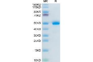 BAMBI Protein (AA 27-152) (Fc Tag)